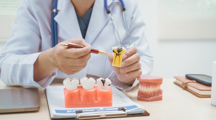 Dentist at Mark Michna, DDS in Greenbrae, CA explaining chipped or cracked tooth with a dental model.